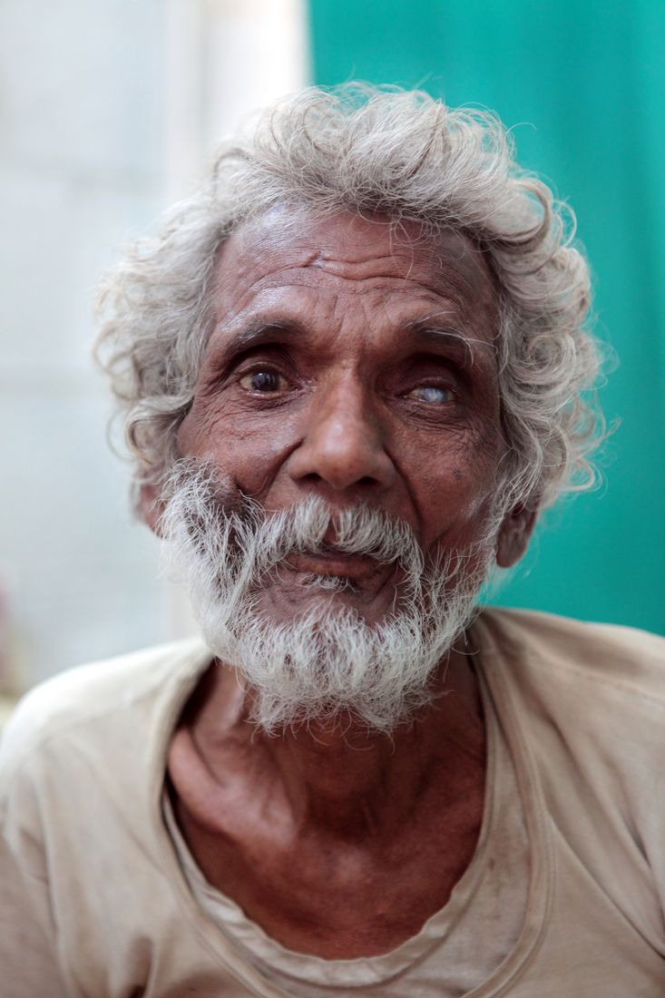 Man with leprosy